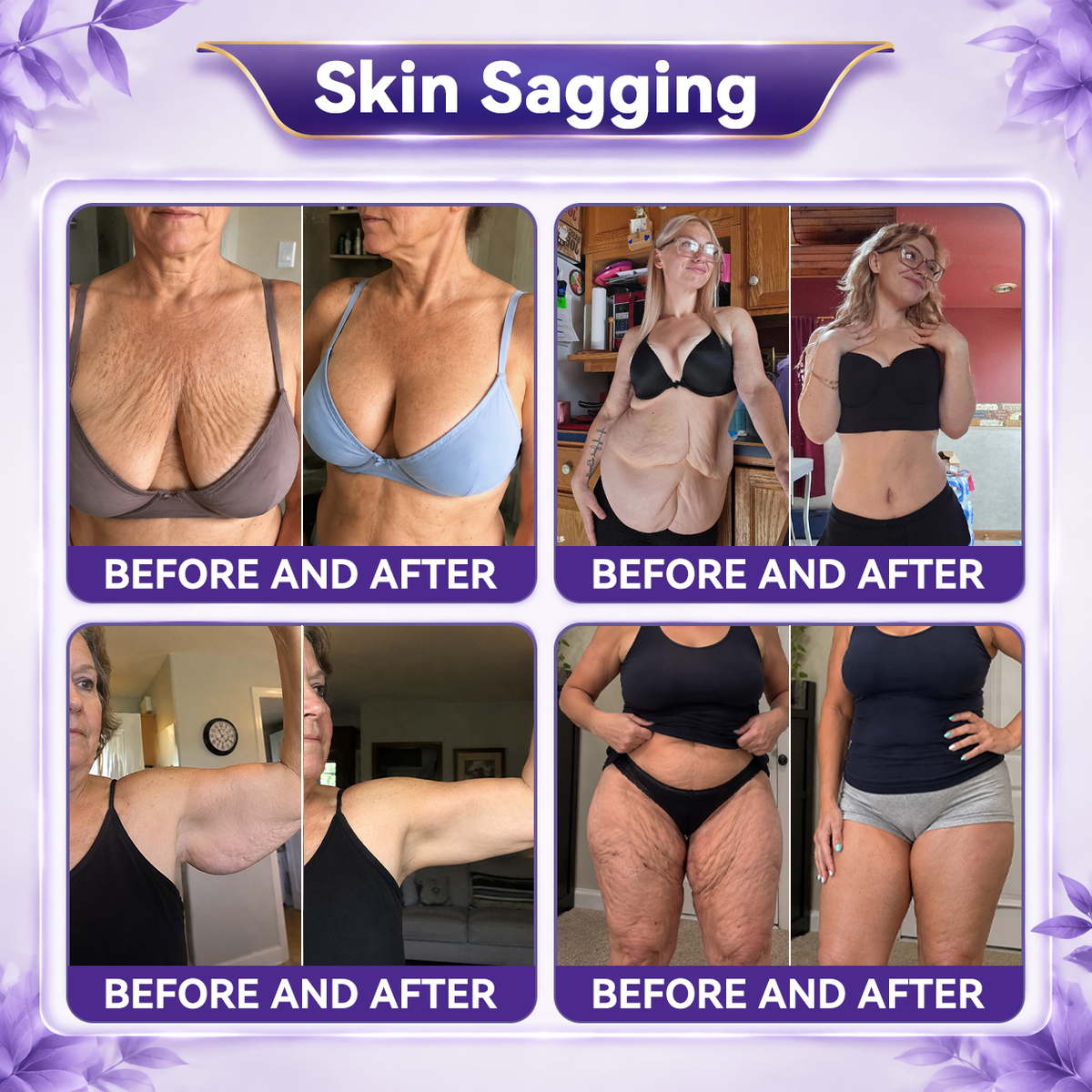 𝐆𝐀𝐅𝐀𝐂𝐄®💎𝐀𝐞𝐭𝐡𝐞𝐫𝐢𝐨𝐧-𝐗𝟗™ 𝟓-𝐏𝐨𝐢𝐧𝐭 𝐑𝐨𝐥𝐥𝐞𝐫 𝐅𝐢𝐫𝐦𝐢𝐧𝐠 𝐂𝐫𝐞𝐚𝐦 Quantum Ceramic Matrix · Collagen · Fullerene🥑